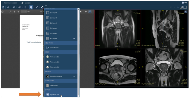 Portal pacjenta - pozycja export DICOM
